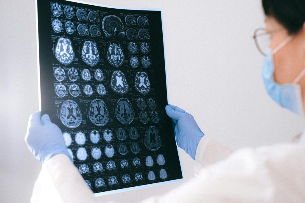 Doctor looking at X-ray